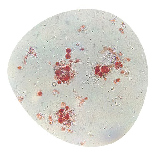Laboratory analysis of biological material under microscope